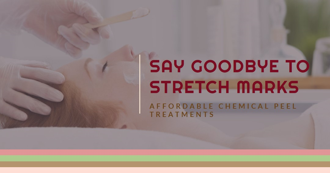 chemical peel for stretch marks