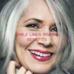 dermal fillers smile lines