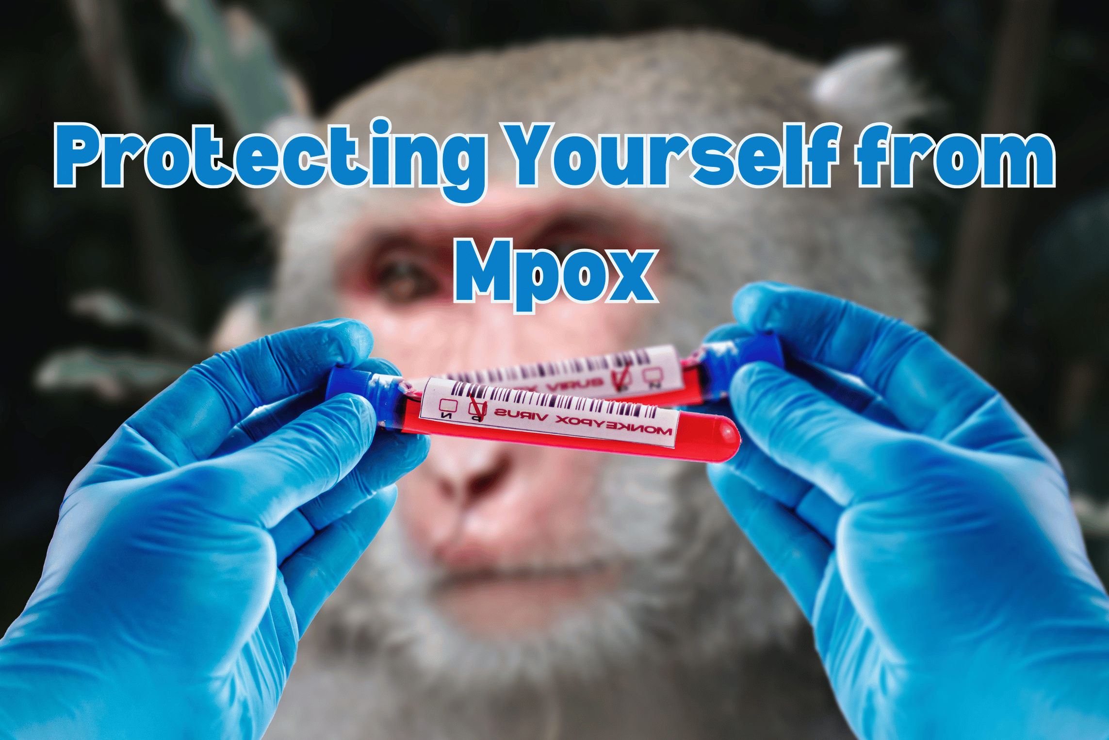 Mpox Outbreak 2024: A Global Health Emergency