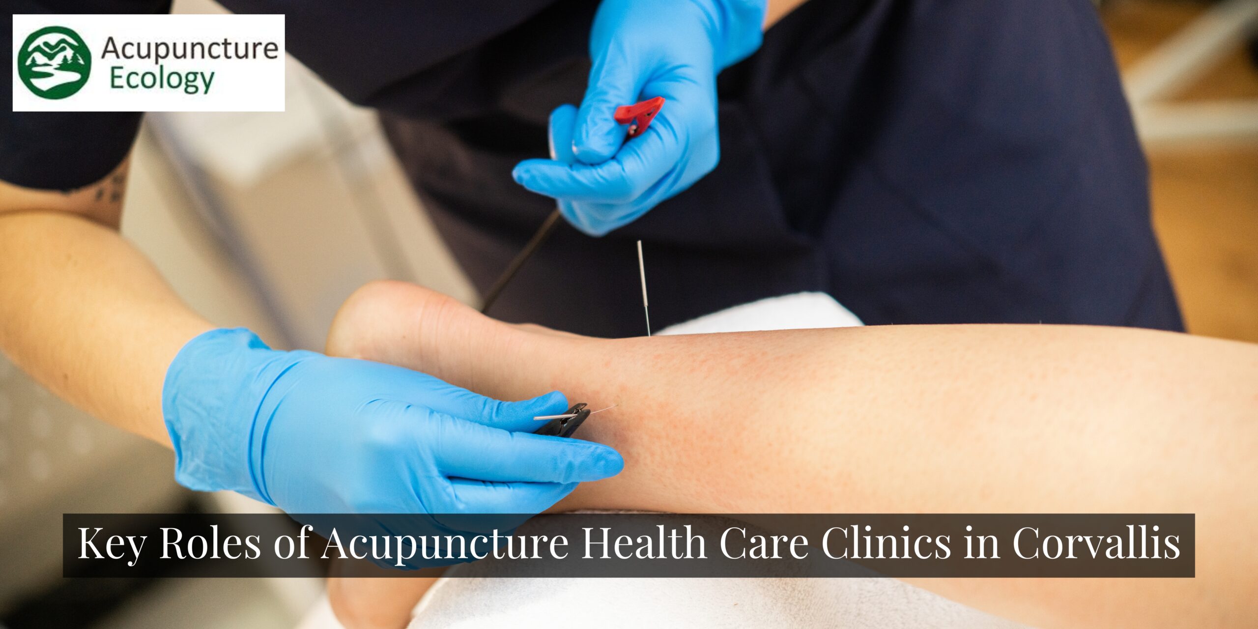 Key Roles of Acupuncture Health Care Clinics in Corvallis