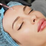 How Long Does Botox Last? Factors That Affect Longevity