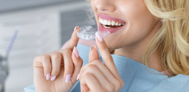 Say Goodbye to Braces: Clear Teeth Aligners for a Perfect Smile