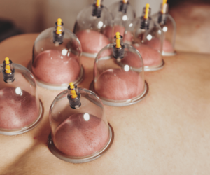 Cupping (Vacuum) massage with cups is the safest and most effective procedure.