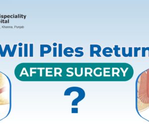 Debunking the Myth: Will Piles Return After Surgery?