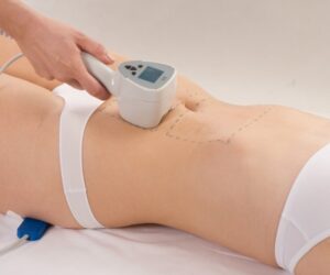 Radiofrequency Body Sculpting: Understanding the Science Behind RF-Based Fat Reduction