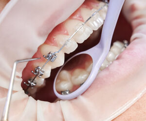 Experience Exceptional Care with a Dentist in Doreen