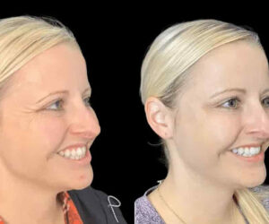 Best Aesthetic Clinic in Dubai for Botox: Enhance Your Natural Beauty