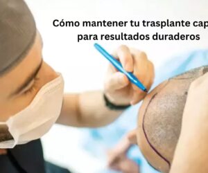 Cómo mantener tu trasplante capilar para resultados duraderos