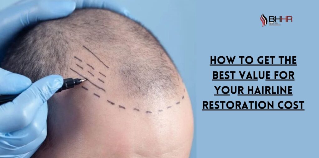 hairline restoration cost