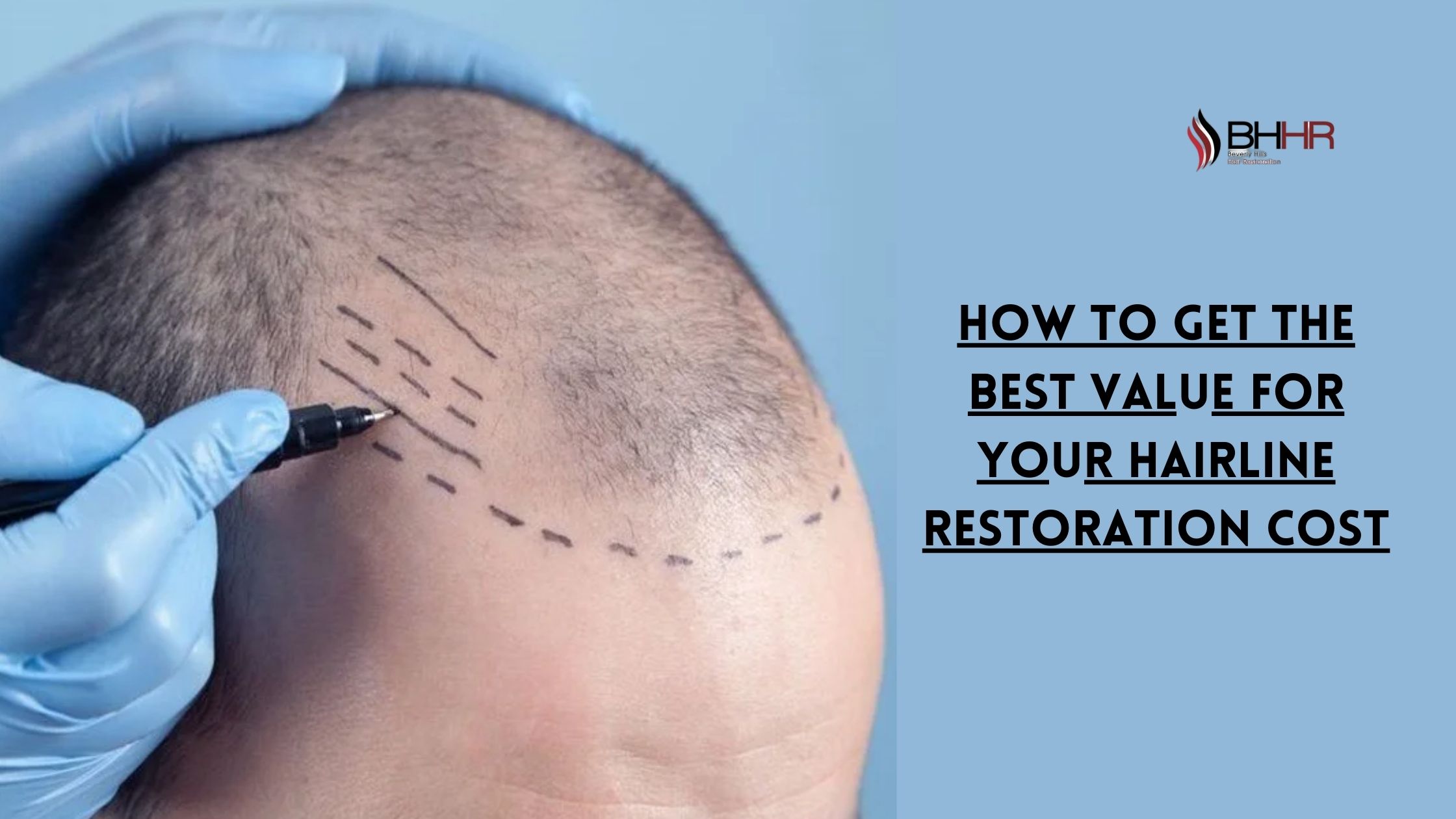 hairline restoration cost