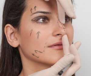 What Are the Most Impressive Rhinoplasty Before and After Results?
