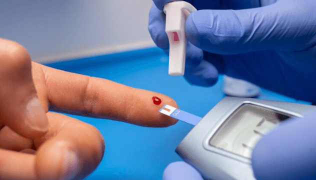 Glucose Fasting test
