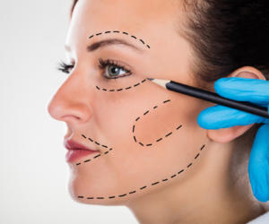 How Can Thread Lift Treatment Enhance Lip Contours?
