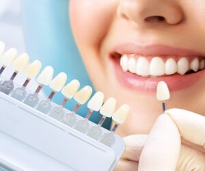 Enhance Your Smile with Cosmetic Dentistry at Orb Dental Scarborough