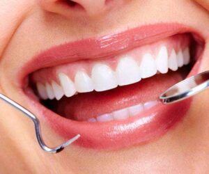 Cosmetic Dentistry in McKinney, TX: Enhancing Your Smile with Confidence