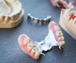Rediscover Your Smile with High-Quality Dentures at Orb Dental Brampton