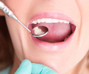 Same-Day Emergency Dentistry: Getting Immediate Relief for Dental Pain
