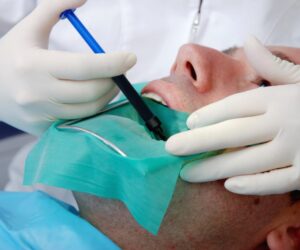Root Canal in McKinney: Everything You Need to Know