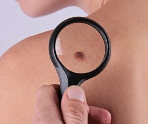 From Skin Tags to Keloids: Scottsdale’s Leading Skin Specialists