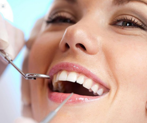 Zirconia Implants in Tampa: A Comprehensive Guide