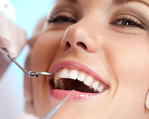 Zirconia Implants Tampa