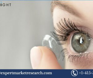 Global Contact Lenses Market Overview by 2034