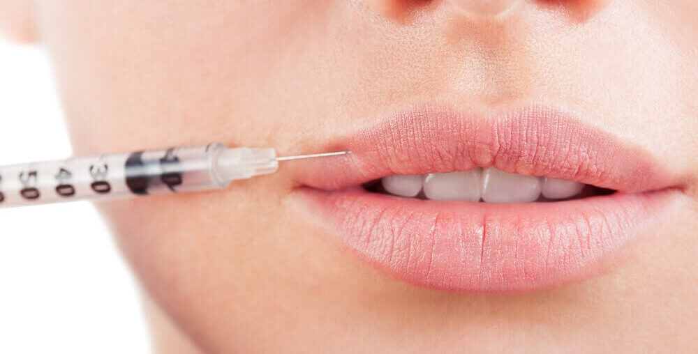 Lip Filler Injections in Dubai