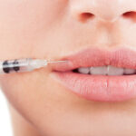 Lip Filler Injections in Dubai