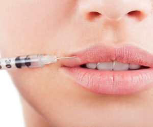 When Is the Right Time for Lip Filler Injections in Dubai?