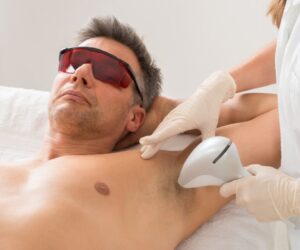 What Every Man Should Know About Laser Hair Removal Procedures