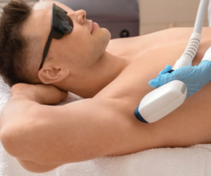 Exploring Male Laser Hair Removal for Lasting Smoothness