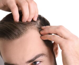 The Finasteride Effect: Fuller, Thicker, Stronger Hair