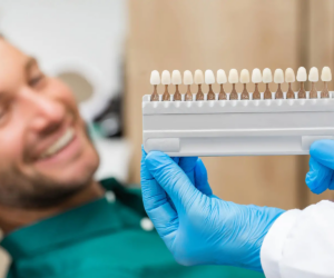 Dental Veneers Before & After: The Key to Achieving Your Dream Smile