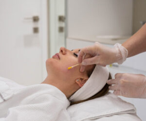 Understanding Melasma: A Detailed Guide to Treatment Options