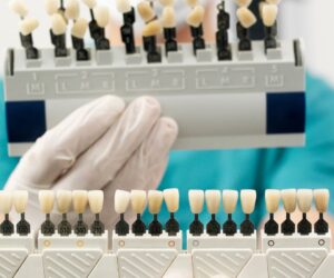 Important Considerations Before Choosing Dental Veneers