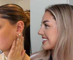 5 Oculoplastic Surgeons in Chicago That Deserve a Second Look