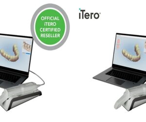 How Are iTero Scanners Used in Restorative Dentistry?