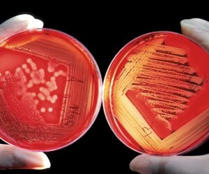 BS Microbiology Entrance Exam Syllabus