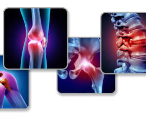 Aspadol 50mg for Chronic Pain: How It Works and Who Needs It