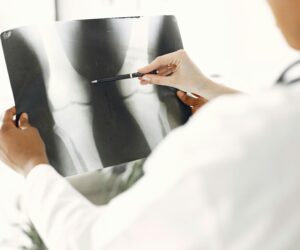 Best Orthopedic Surgeon in Nagpur: Expert in Knee, Hip & Elbow Replacement