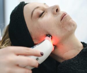 Transform Your Skin with Fractional CO2 Laser Treatment