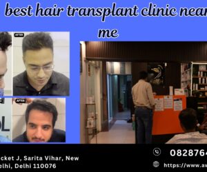Top Hair Transplant Clinics in Delhi Finding the Best Near You