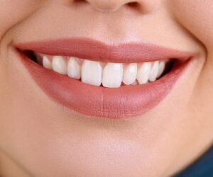 Does Teeth Whitening Work on All Tooth Shades?