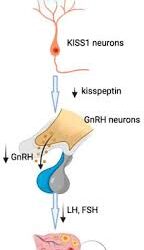 Dopamine Agonists for Menstrual Disorders & Prolactinomas