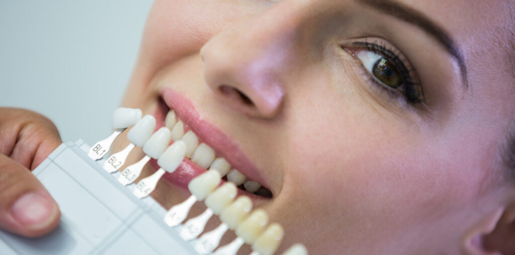 Teeth Whitening Christchurch
