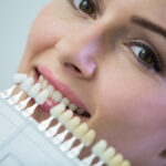 Teeth Whitening Christchurch