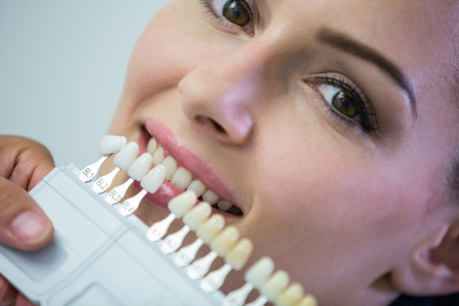 Teeth Whitening Christchurch