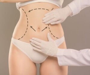 Transform Your Midsection with Tummy Tuck Surgery in Dubai by Dr. Hans