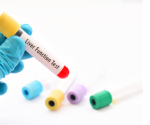 How much does a liver function test cost?