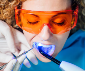 Teeth Whitening Boosts Self-Confidence and Improves Self-Esteem